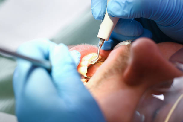 Best Walk-In Emergency Dentist in Minneapolis, MN